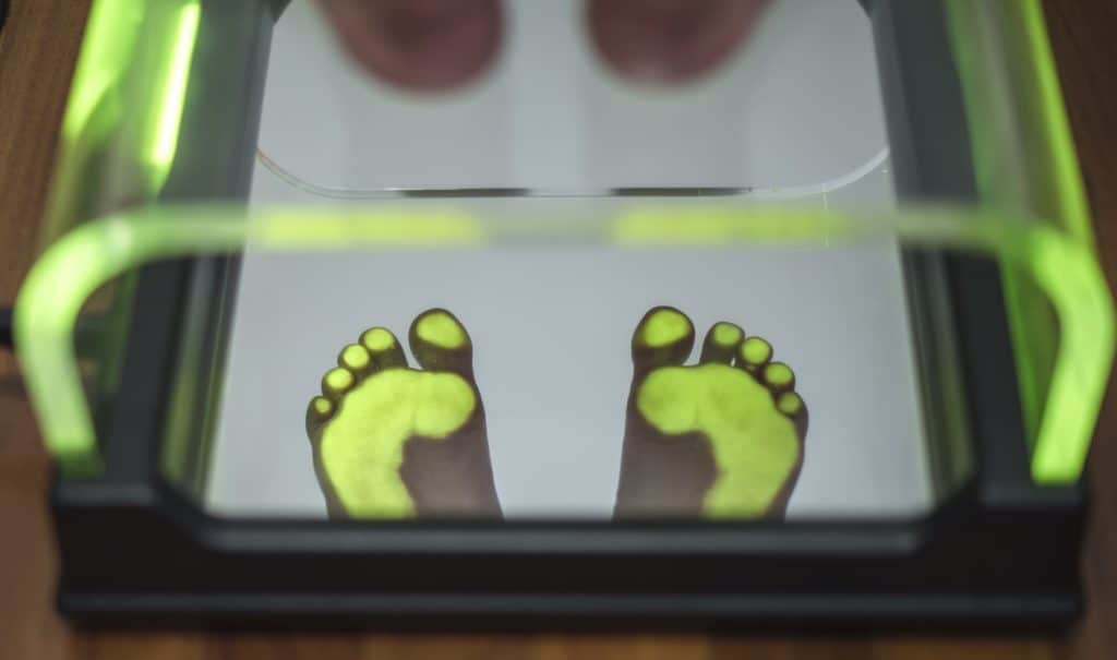 voeten scan
